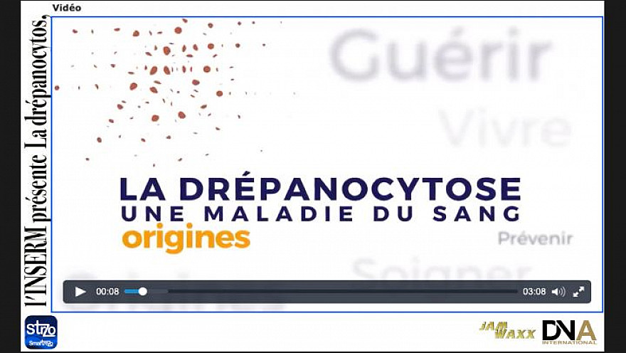 Tv Locale Paris  présente un Reportage réalisé par l'INSERM - La drépanocytos, qu'est ce que c'est ?